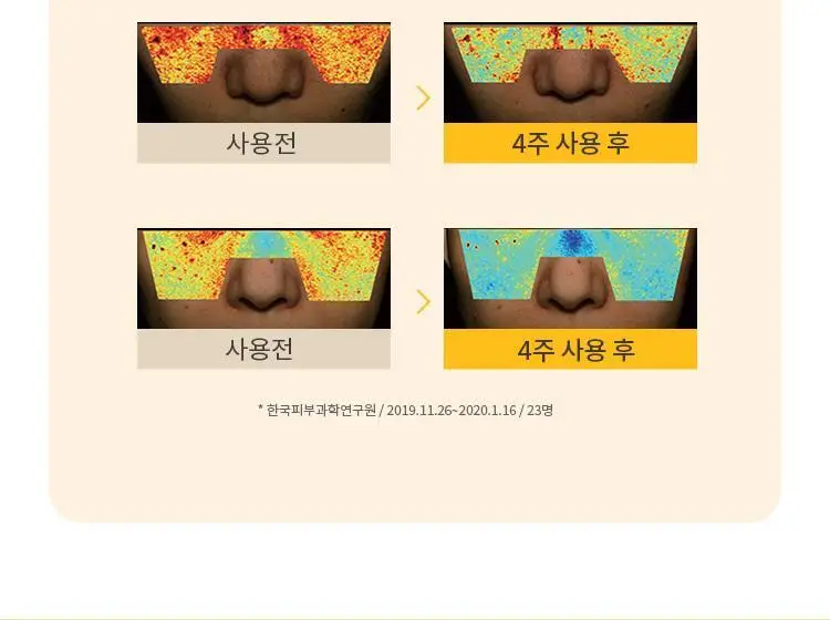 [NEW] 미샤 텔레토비 콜라보 비타씨플러스 잡티씨 탄력 앰플 30ml 키링 기획 상세페이지 16
